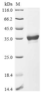 Greater than 85% as determined by SDS-PAGE.