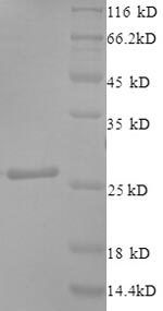 Greater than 90% as determined by SDS-PAGE.