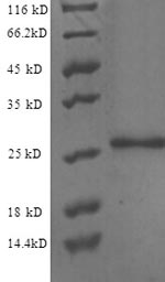 Greater than 90% as determined by SDS-PAGE.