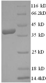 Greater than 90% as determined by SDS-PAGE.