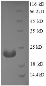 Greater than 90% as determined by SDS-PAGE.