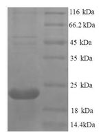 Greater than 90% as determined by SDS-PAGE.