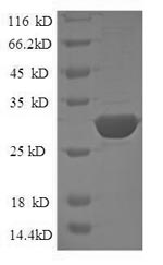 Greater than 90% as determined by SDS-PAGE.