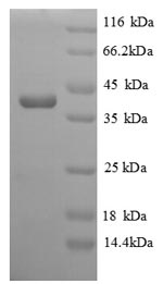 Greater than 90% as determined by SDS-PAGE.