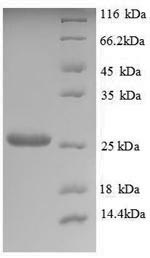 Greater than 90% as determined by SDS-PAGE.