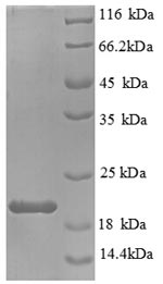 Greater than 90% as determined by SDS-PAGE.