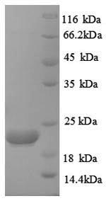 Greater than 90% as determined by SDS-PAGE.