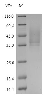 Greater than 90% as determined by SDS-PAGE.