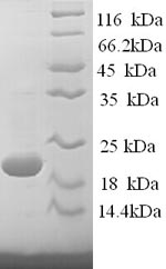 Greater than 90% as determined by SDS-PAGE.