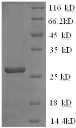 Greater than 90% as determined by SDS-PAGE.