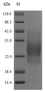 Greater than 85% as determined by SDS-PAGE.