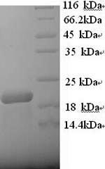 Greater than 90% as determined by SDS-PAGE.