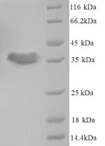 Greater than 90% as determined by SDS-PAGE.