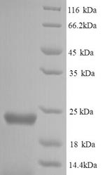 Greater than 90% as determined by SDS-PAGE.