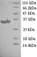 Greater than 90% as determined by SDS-PAGE.