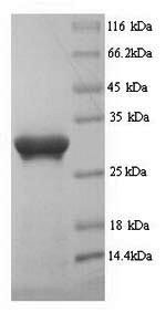 Greater than 90% as determined by SDS-PAGE.