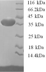 Greater than 90% as determined by SDS-PAGE.