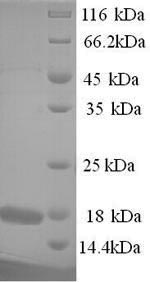 Greater than 90% as determined by SDS-PAGE.