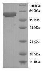 Greater than 90% as determined by SDS-PAGE.