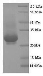 Greater than 90% as determined by SDS-PAGE.