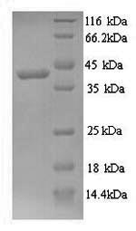 Greater than 90% as determined by SDS-PAGE.