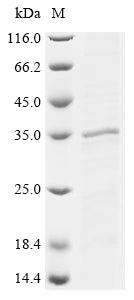 Greater than 85% as determined by SDS-PAGE.