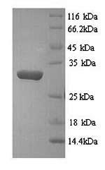 Greater than 90% as determined by SDS-PAGE.