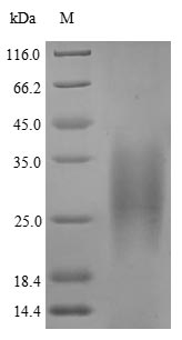 Greater than 90% as determined by SDS-PAGE.