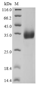 Greater than 90% as determined by SDS-PAGE.