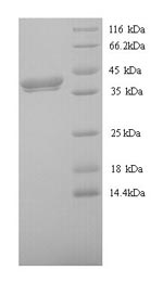 Greater than 90% as determined by SDS-PAGE.