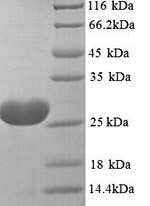 Greater than 90% as determined by SDS-PAGE.