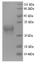 Greater than 90% as determined by SDS-PAGE.