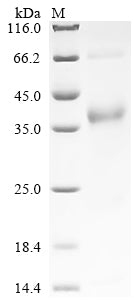 Greater than 90% as determined by SDS-PAGE.