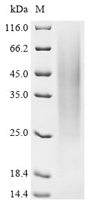 Greater than 85% as determined by SDS-PAGE.