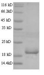 Greater than 90% as determined by SDS-PAGE.