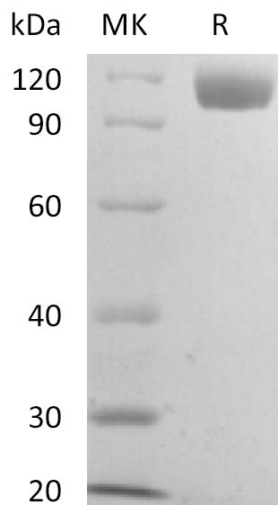 BL-2674NP: Greater than 95% as determined by reducing SDS-PAGE. (QC verified)