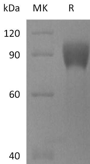 BL-2215NP: Greater than 95% as determined by reducing SDS-PAGE. (QC verified)