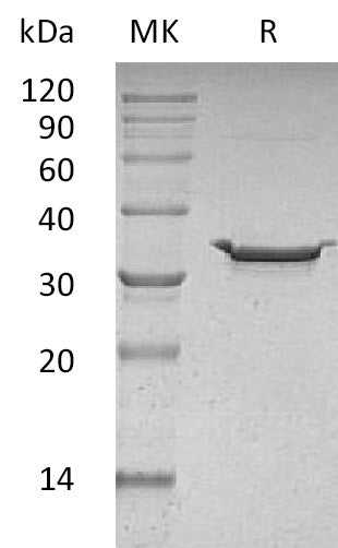 BL-0295NP: Greater than 95% as determined by reducing SDS-PAGE. (QC verified)