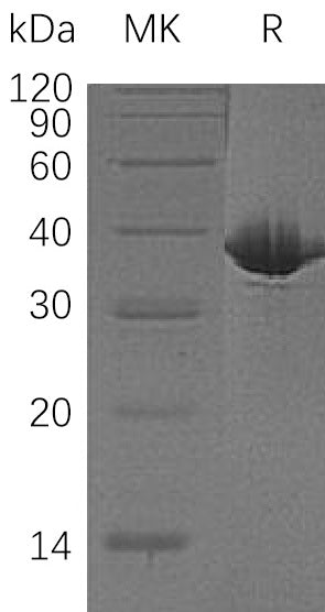 BL-0299NP: Greater than 95% as determined by reducing SDS-PAGE. (QC verified)