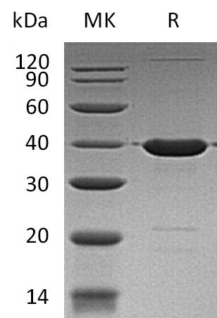 BL-0247NP: Greater than 95% as determined by reducing SDS-PAGE. (QC verified)