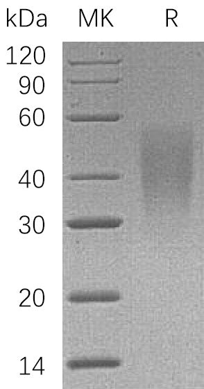 BL-0405NP: Greater than 95% as determined by reducing SDS-PAGE. (QC verified)