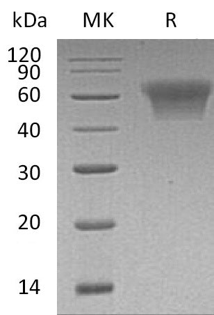 BL-0404NP: Greater than 95% as determined by reducing SDS-PAGE. (QC verified)