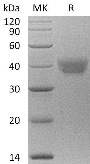 BL-0418NP: Greater than 95% as determined by reducing SDS-PAGE. (QC verified)