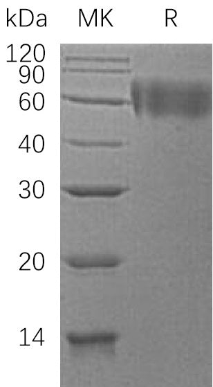 BL-0407NP: Greater than 95% as determined by reducing SDS-PAGE. (QC verified)