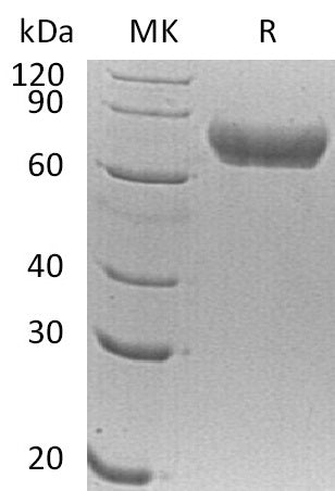 BL-0422NP: Greater than 95% as determined by reducing SDS-PAGE. (QC verified)