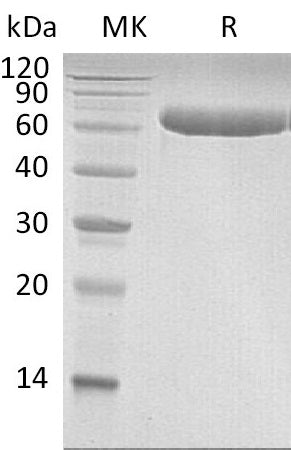 BL-0431NP: Greater than 95% as determined by reducing SDS-PAGE. (QC verified)