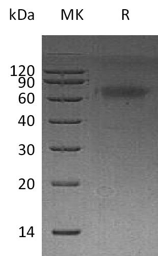 BL-0452NP: Greater than 95% as determined by reducing SDS-PAGE. (QC verified)