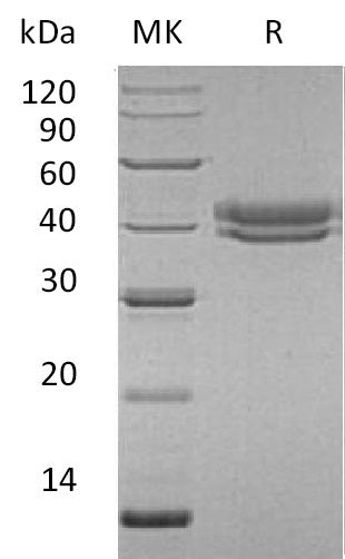 BL-0556NP: Greater than 95% as determined by reducing SDS-PAGE. (QC verified)