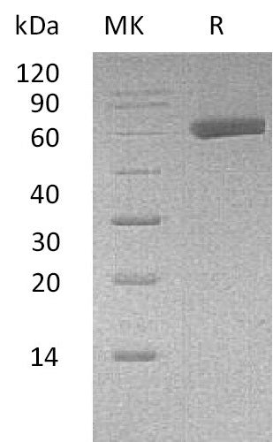 BL-0566NP: Greater than 95% as determined by reducing SDS-PAGE. (QC verified)