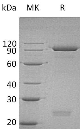 BL-0577NP: Greater than 95% as determined by reducing SDS-PAGE. (QC verified)